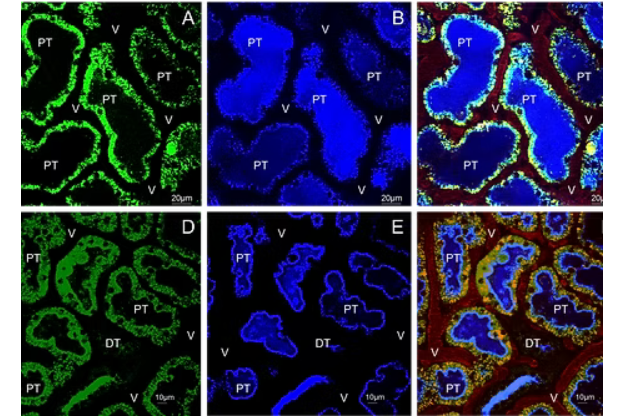 A demonstration of RESTARI's capability to deliver gene therapies into renal cells